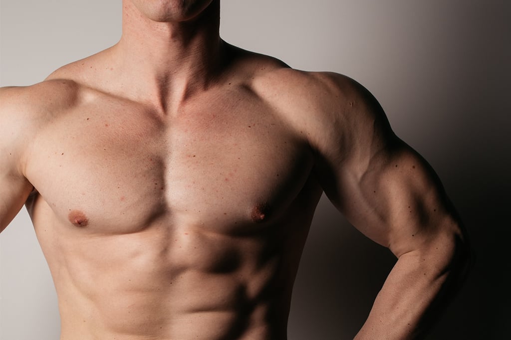 Gynecomastia in Tijuana, Mexico is an increase in the amount of breast gland tissue in boys or men. An imbalance of the hormones estrogen and testosterone causes it.