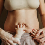 Transform your body with a mommy makeover surgery in Tijuana, Mexico